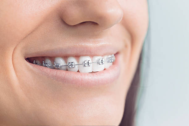 Best Wisdom Tooth Removal  in Fort Davis, TX